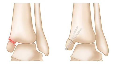 Fracture Repair service image