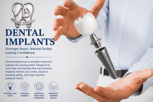 Dental Implants service image