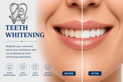 Teeth Whitening service image
