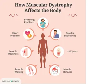 Neuromuscular Disorders (Special Focus) service image