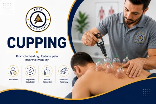 Cupping service image