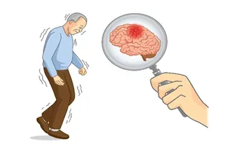 Movement Disorders service image