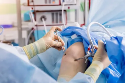 Arthroscopy Treatment service image
