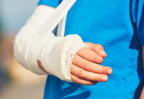 Fracture Repair Treatment service image