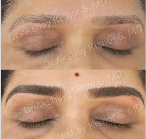 Eyebrows Microblading And Micropigmentation  service image