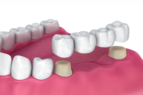 Denture Treatment service image