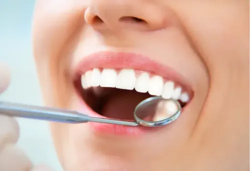 CorticobasalI Implants service image