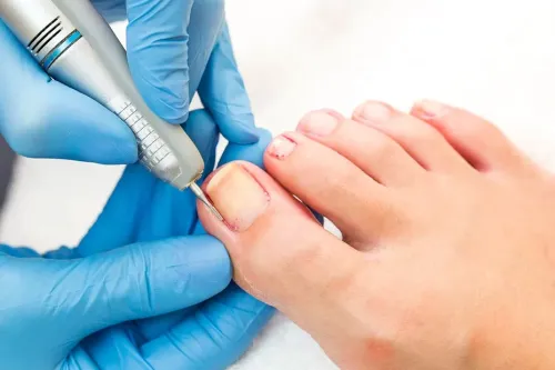 Hair & Nail Treatment in Aundh, Sanghvi, Baner, Balewadi, Pashan, Pune service image