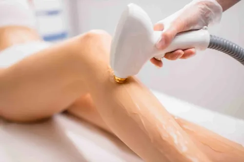 Laser Hair Removal Treatment in Aundh, Sanghvi, Baner, Balewadi, Pune service image
