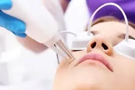 Acne Scar Laser Treatment in Aundh, Sanghvi, Baner, Balewadi, Pashan, Pune service image