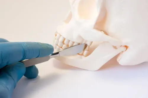 Orthognathic or Corrective Jaw Surgery service image
