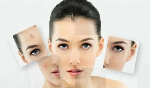 Dermatologist in Aundh, Sanghvi, Baner, Balewadi, Pashan, Pune service image