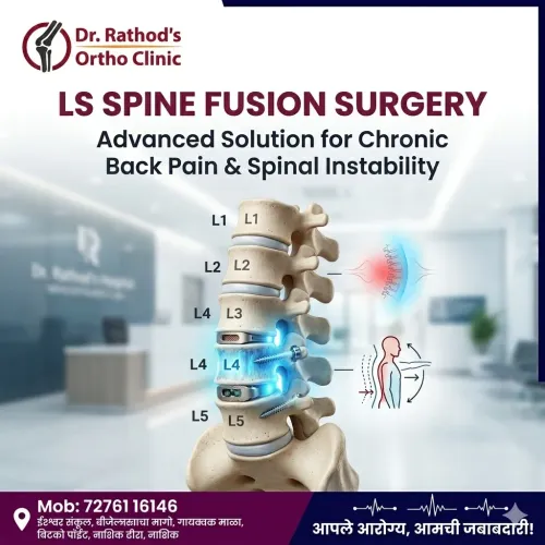 LS Spine Fusion Surgery service image
