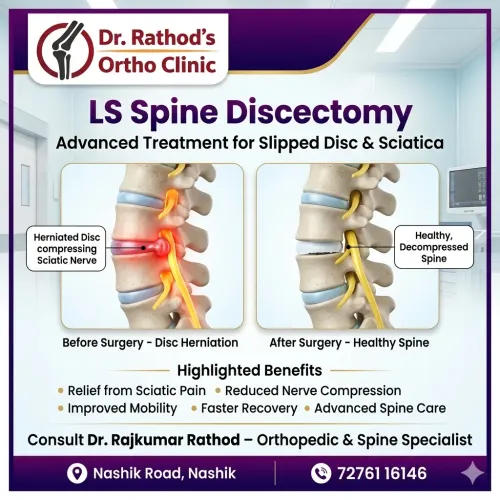 LS Spine Discectomy service image