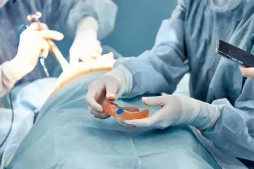 Reconstructive Surgeries service image