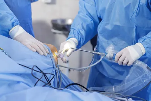 Arthroscopic Surgery service image
