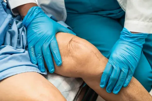 Joint Replacement Surgery service image