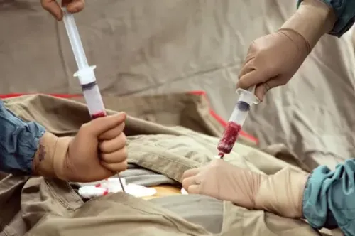 Bone Marrow Aspiration service image