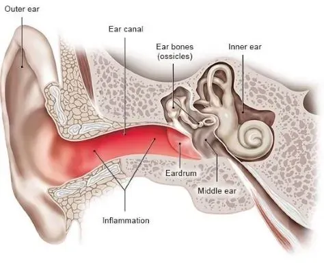 Ear Discharge (Otorrhea) – Causes, Symptoms & Treatment service image