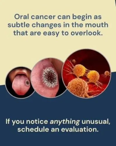 Evaluation of Oral Cancers service image