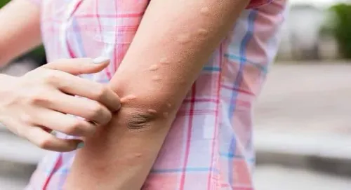 Fungal Infection Treatment service image