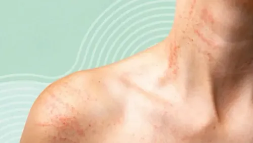 Allergic Skin Conditions & Rashes service image