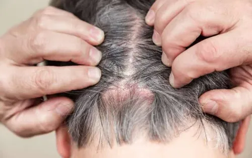 Hair and Scalp Disorders service image