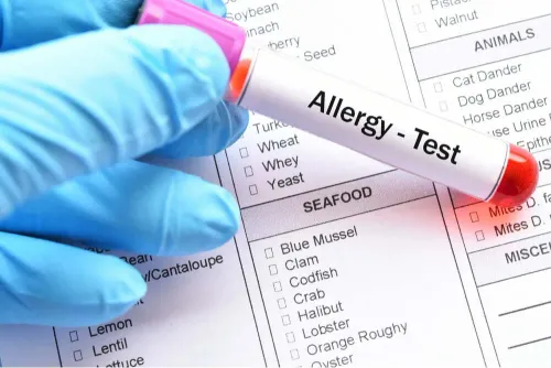 Allergy Testing service image