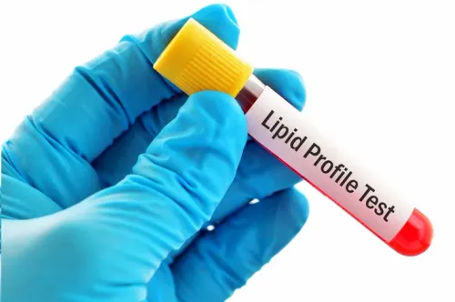 Lipid Profile & Cholesterol Testing service image