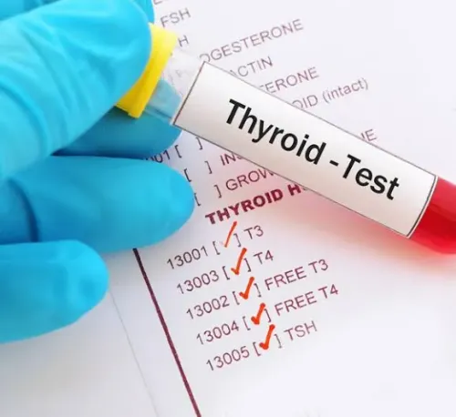 Thyroid Function Test  service image