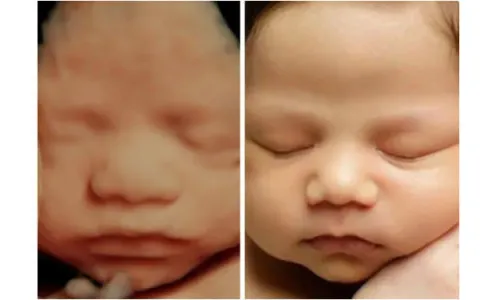 4D Ultrasound service image