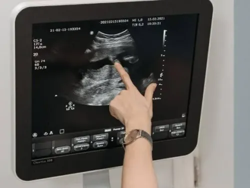 Govt-Recommended Pregnancy ECHO service image