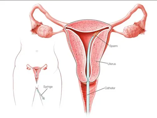  IUI service image