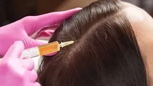 Customized hair restoration plans service image