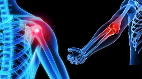 Shoulder and Elbow Surgery service image