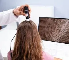 Hair fall evaluation and treatment service image