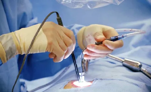 Minimally invasive spine surgery service image