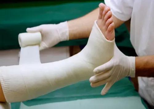 Fracture Management and Treatment service image