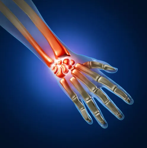 Hand and wrist surgery service image