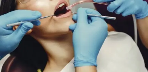 Gum Treatment service image