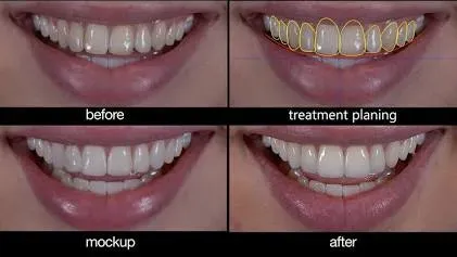 Smile Design service image