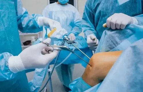 Arthroscopy for Knee and Shoulder (700+ surgeries) service image
