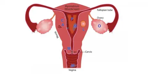 Menstrual Disorders Management service image