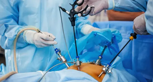 Laparoscopic Gynaecologist service image