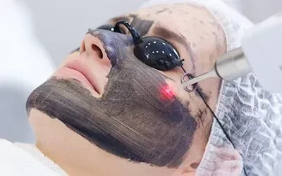 Carbon Laser Toning Treatment service image