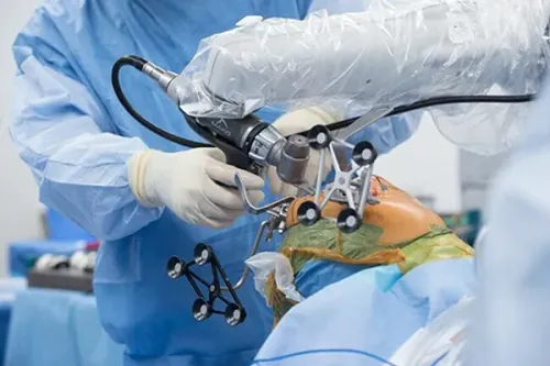 Robotic Knee Replacement Surgeon in Aundh, Sanghvi, Pune service image