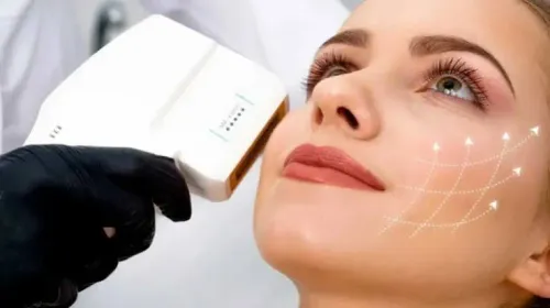 HIFU Treatment service image