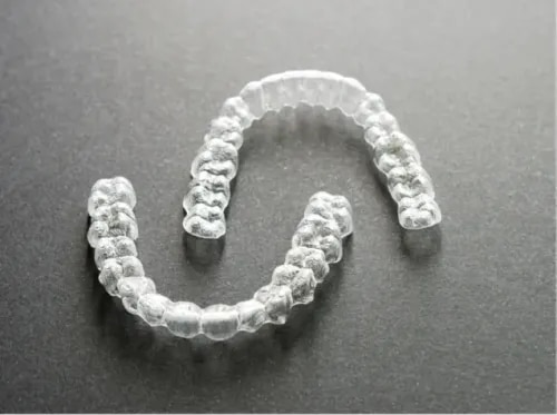 Teeth Alignment Treatment for a Healthy, Confident Smile service image
