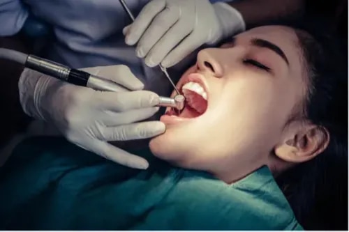 Root Canal Treatment service image