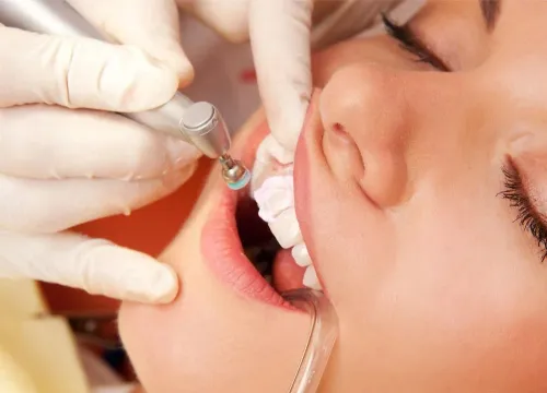 Teeth Cleaning (Scaling & Polishing) service image